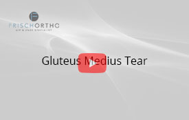 Gluteus Medius Tear