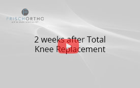 2 weeks after Total Knee Replacement