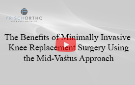 The Benefits of Minimally Invasive Knee Replacement Surgery Using the Mid-Vastus Approach